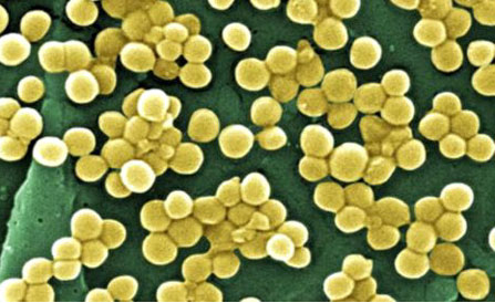 顯微鏡下的“超級病菌”NDM-1。