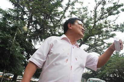 青島男子煤屋被城管拆砸玻璃泄憤 碎片插入鄰居眼角 青島男子煤屋被城管拆砸玻璃泄憤 碎片插入鄰居眼角