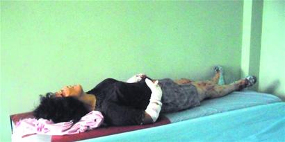 養8年寵物狗把主人咬成重傷 因天熱發狂 養8年寵物狗把主人咬成重傷 因天熱發狂