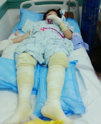 青島冒險鴨游船因故障突然爆炸 15名游客受傷 青島冒險鴨游船因故障突然爆炸 15名游客受傷