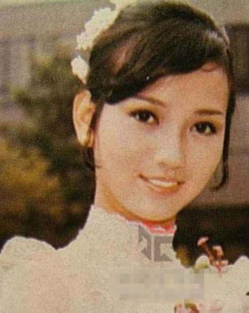 58歲趙雅芝長腿驚現長疤痕 偷情被暴打內幕遭曝光