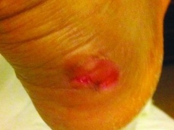 CBA球員抱怨李寧鞋質量太差 后腳跟險被磨爛