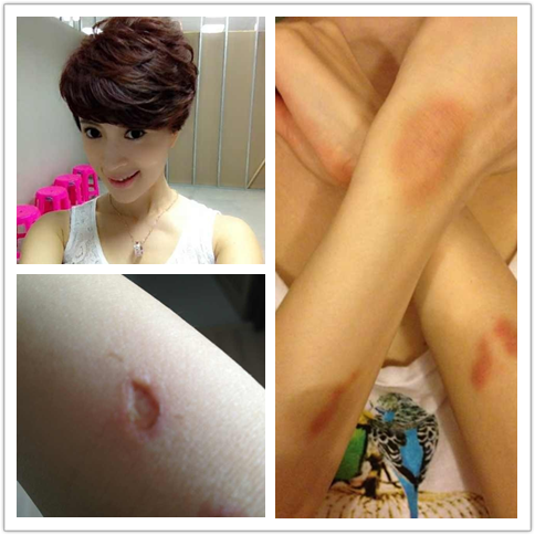 陳奕迅失足摔破睪丸成龍險(xiǎn)喪命 盤(pán)點(diǎn)明星“悲催”受傷史